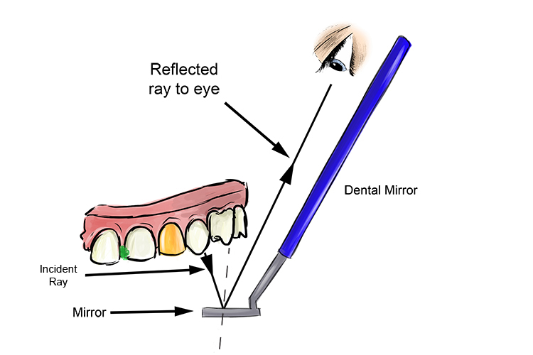 Dental mirror in use